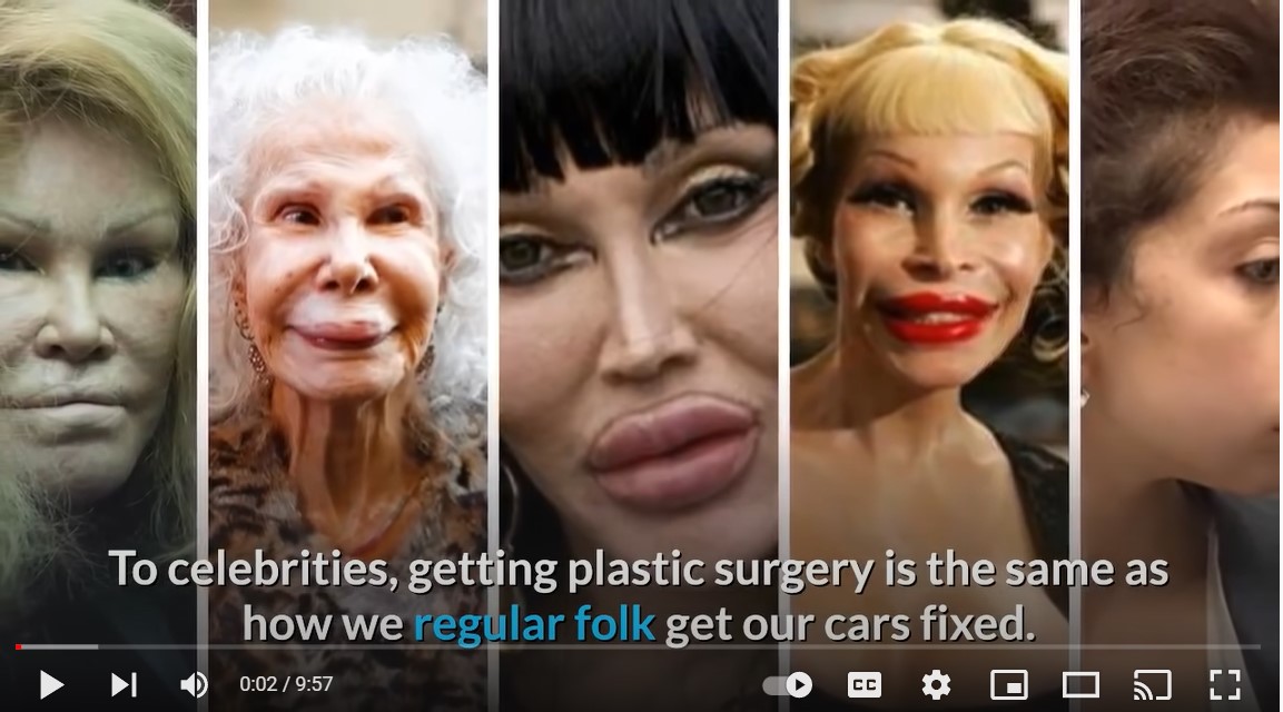 Celebrities Who Have Admitted to Getting Plastic Surgery