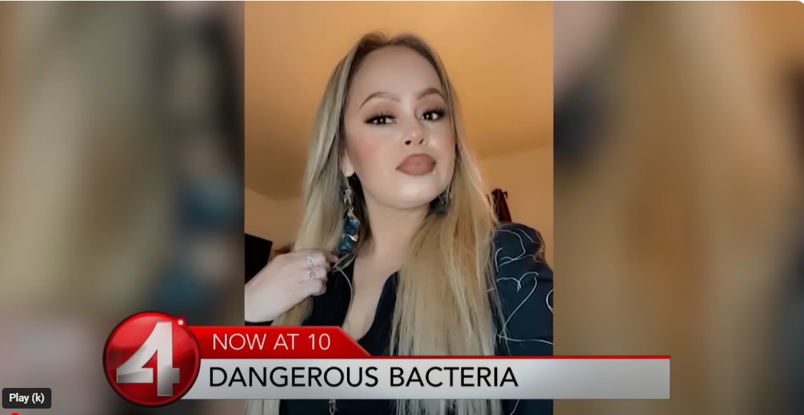 Laura Barajas got a bacterial infection from eating undercooked